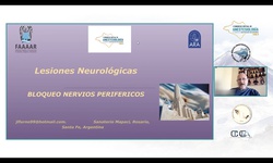 Módulo IV: LASRA México importancia del ultrasonido en Anestesia - Lesiones neurológicas en nervio periférico