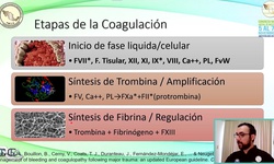 Coagulopatías en Ginecología y Obstetricia