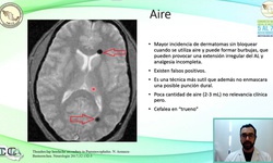 Recomendaciones en Técnicas Neuroaxiales en pacientes Ginecológicas y Obstétricas
